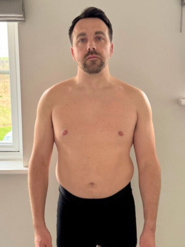 Fraser before